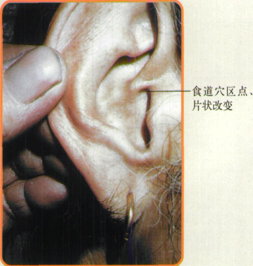 第四節(jié) 胃腸功能紊亂
